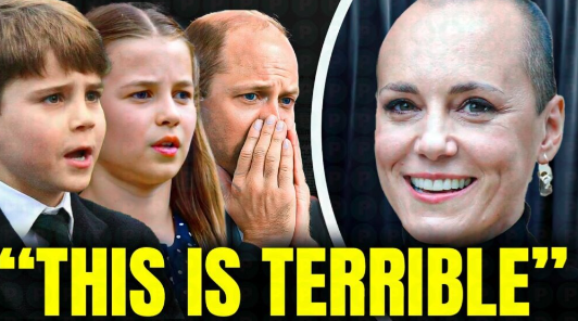 Kate Middleton Reveals Her Real Hair & Why She Wears Wigs: “I apologize for hiding it from you…”