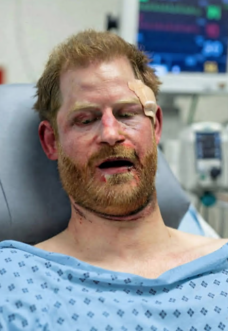 “JUST 1 MINUTE AGO — TOO SHOCKING! Prince Harry Has Been Confirmed to Have